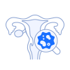 자궁/난소암센터
